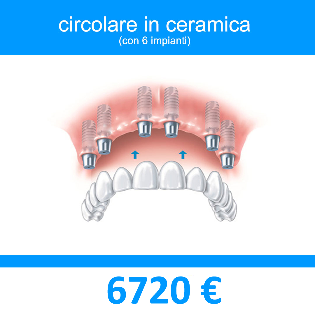 protesi fissa circolare in porcellana portata da 6 mpianti