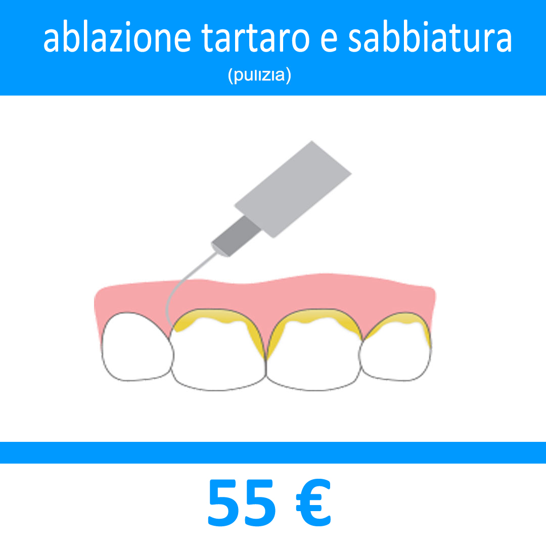 devitalizzazione dentaria, cura canalare, cura endodontica