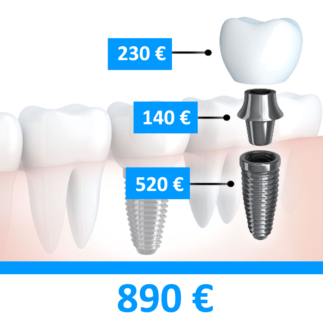 impianto dentale