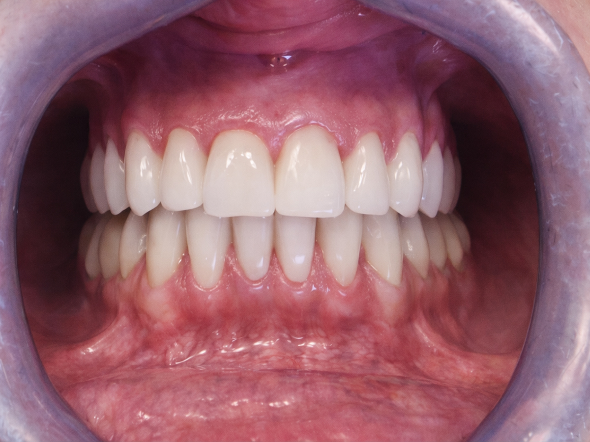 Caso clinico 2 – risultato dopo il trattamento