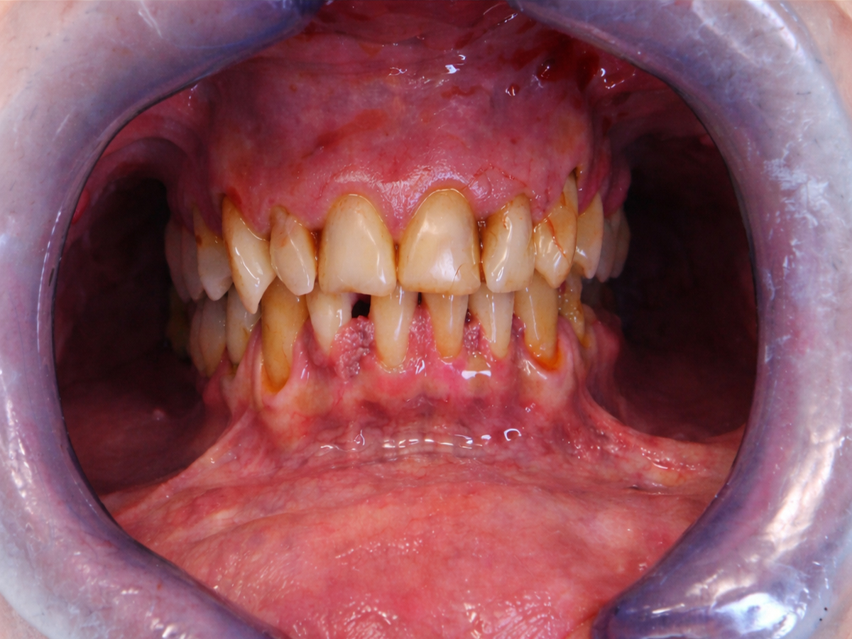 Caso clinico 2 – situazione prima del trattamento