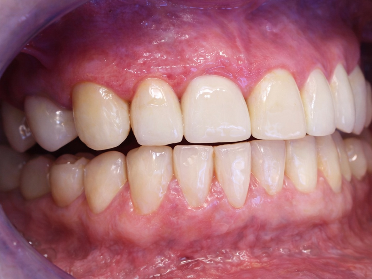 Caso clinico 3 – risultato dopo il trattamento