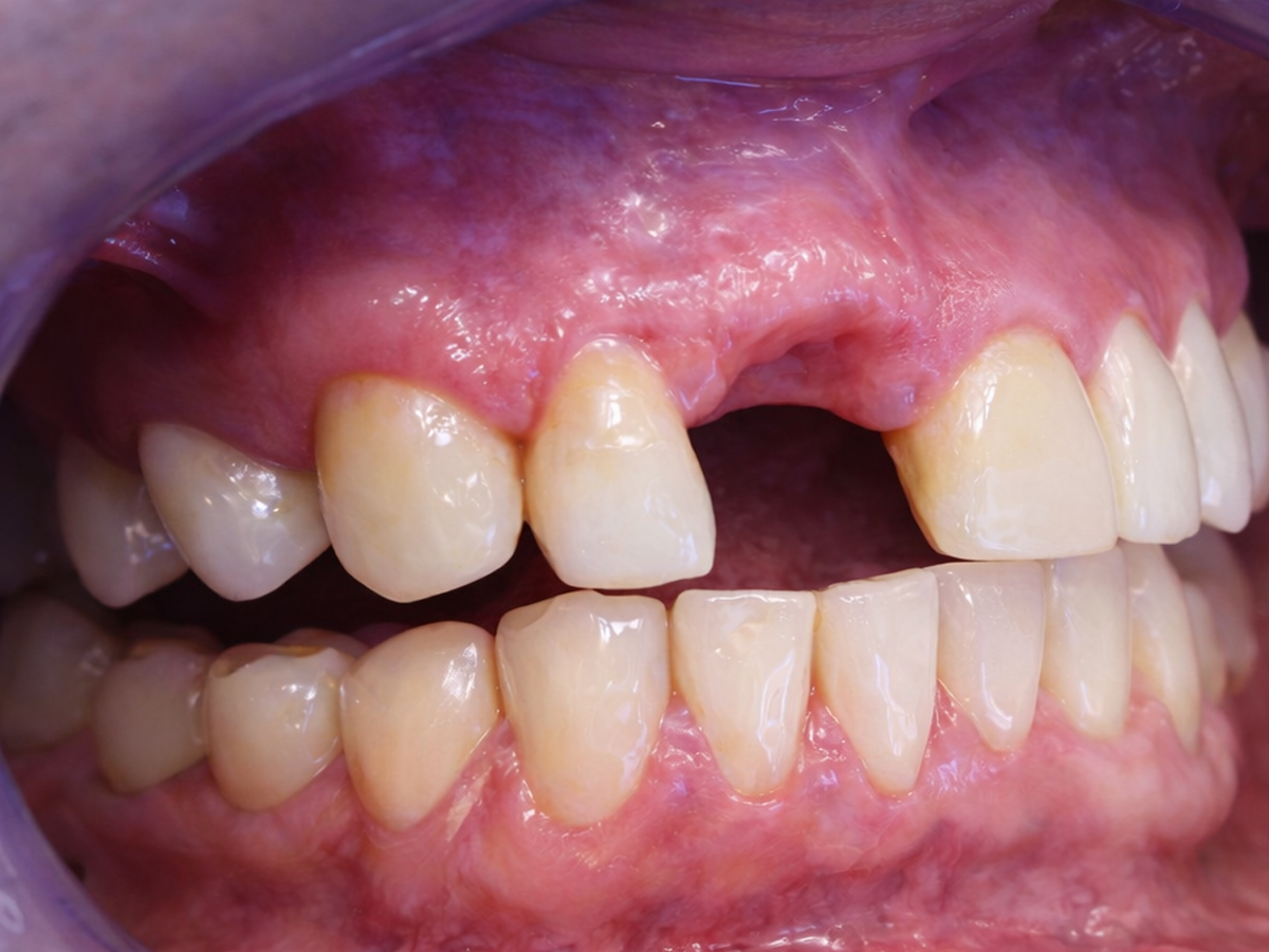 Caso clinico 3 – situazione prima del trattamento