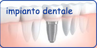 impiantologia, impianto dentale